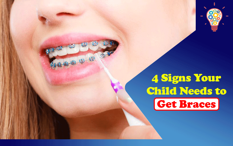 4 Signs Your Child Needs to Get Braces