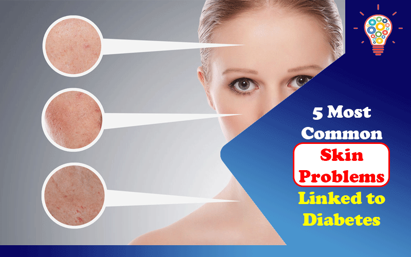 Skin Problems Linked to Diabetes