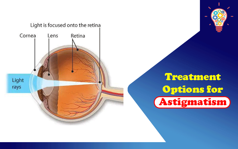 Treatment Options for Astigmatism