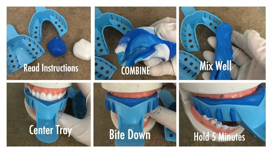 How to use the teeth mold kit